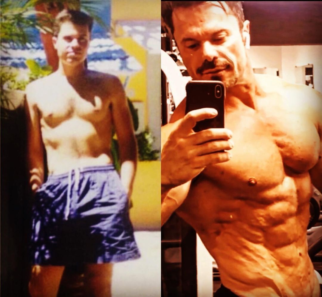 Antes e depois Renato Cariani